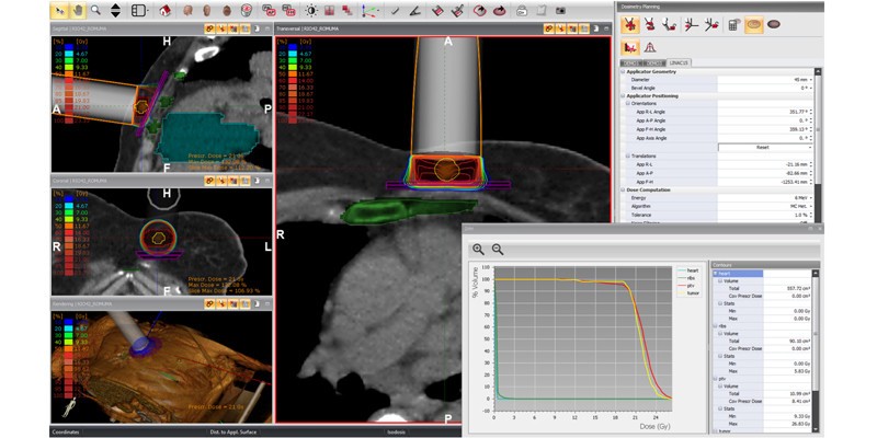 GMV and IntraOp join forces to strengthen the fight against cancer