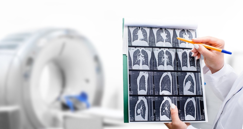np_011_ia-lung-scan.jpg