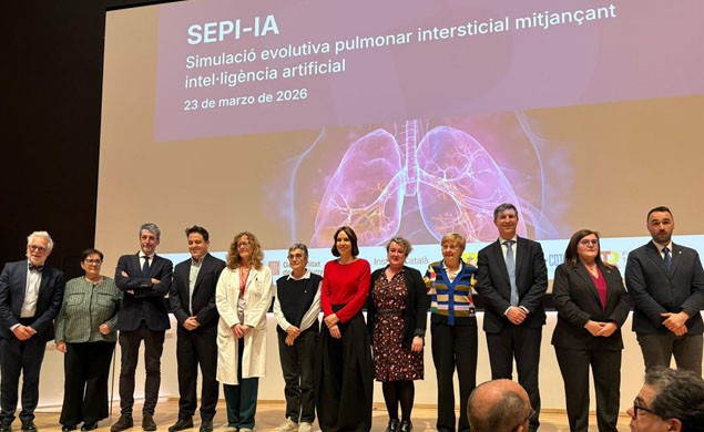 Cesión al Hospital Universitario de Bellvitge de SEPI-IA, prototipo para mejorar con IA el diagnóstico de enfermedades pulmonares, gracias a tecnología de GMV