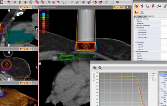 The Provincial Hospital of Castellón has taken up radiance, the world’s only radiosurgery planner