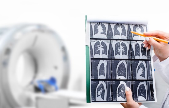 np_011_ia-lung-scan.jpg