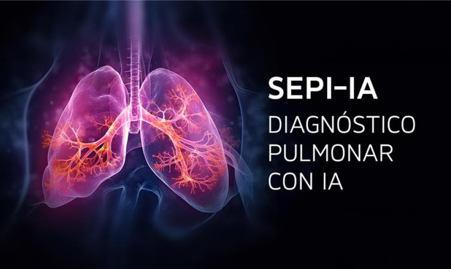 SEPI-IA